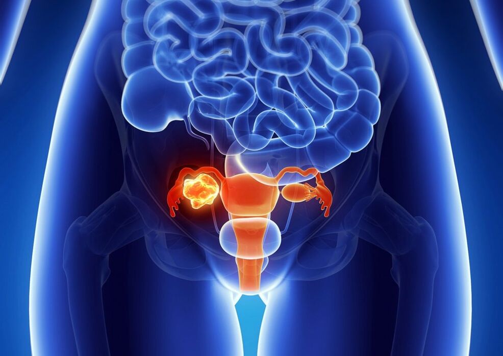 Ovil Pathology of the woman under the influence of alcohol